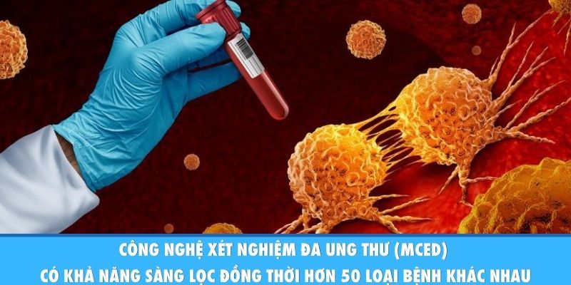 Công nghệ xét nghiệm đa ung thư (MCED) có khả năng sàng lọc đồng thời hơn 50 loại bệnh khác nhau