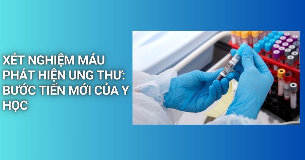 xet nghiem mau phat hien ung thu